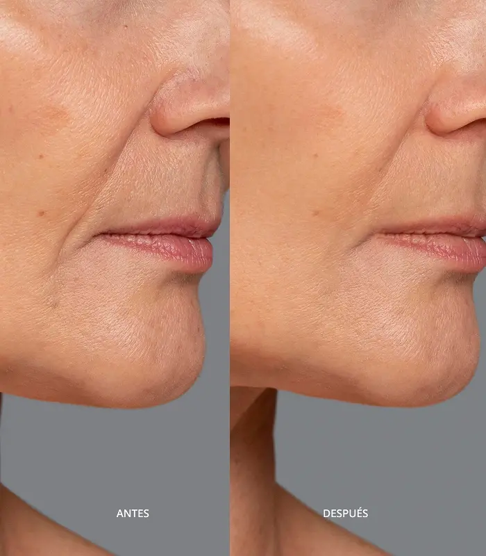 Abril Et Nature Contorno De Labios Hidratante Anti-Arrugas Con Efecto Flash