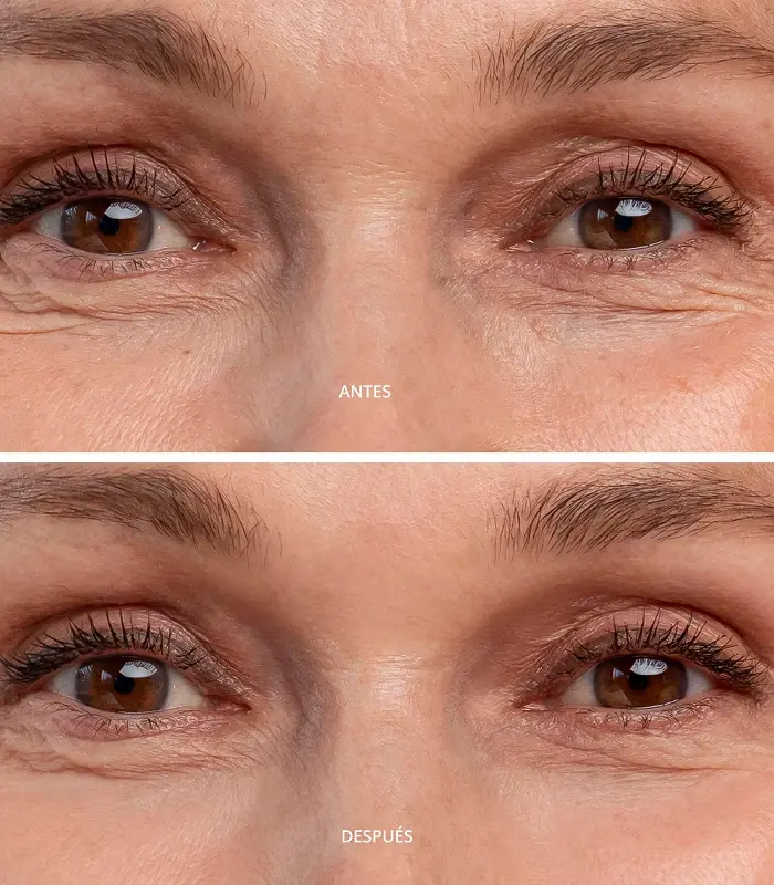 Abril Et Nature Contorno De Ojos Hidratante Para Evitar Las Bolsas Y Ojeras