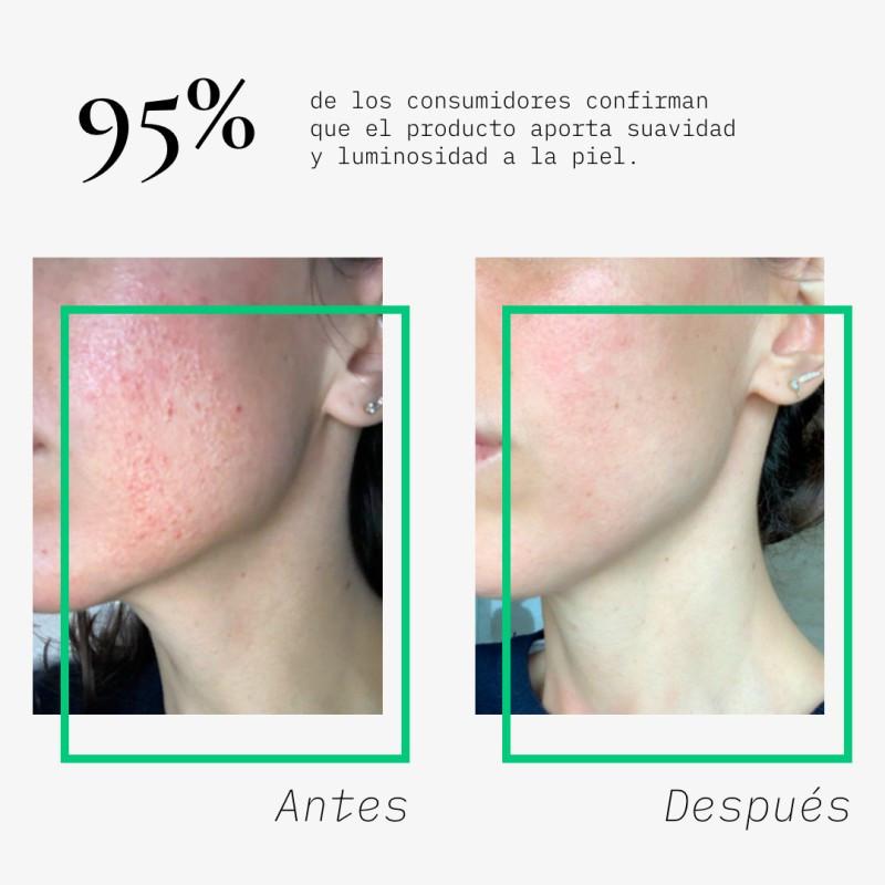 Beauté Mediterranea PACK BYE SENSITIVE SKIN CON ACIDO HIALURONICO Y NIANCINAMIDA