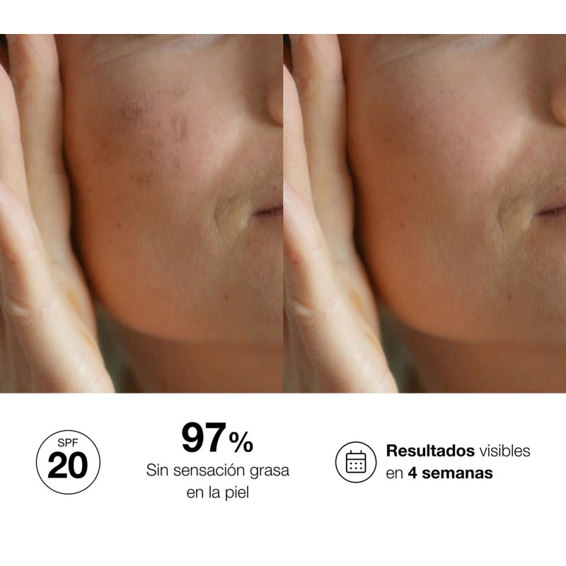 Bella Aurora Bio10 Forte Tratamiento Despigmentante Intensivo Para Piel Mixta-grasa