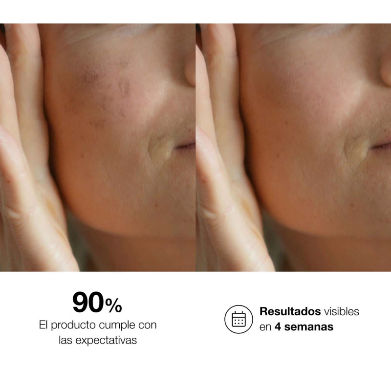 Bella Aurora Bio10 Forte Tratamiento Despigmentante Intensivo Para Todo Tipo De Piel