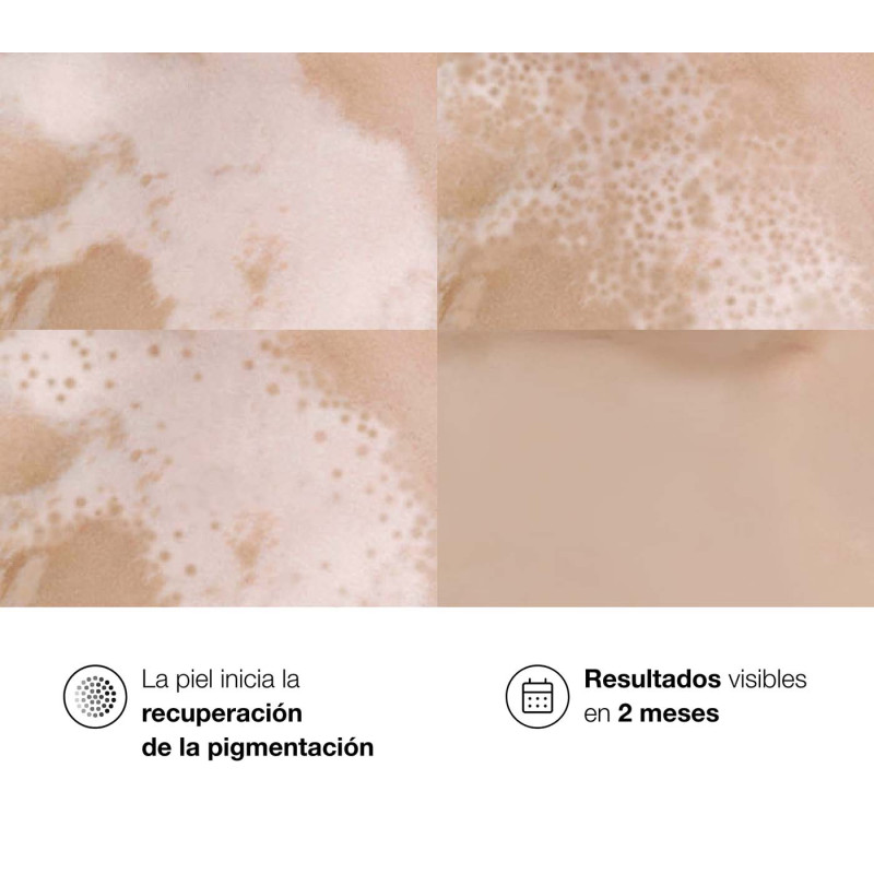 Bella Aurora Repigment12 Plus. Crema Reguladora De La Pigmentación Cutánea