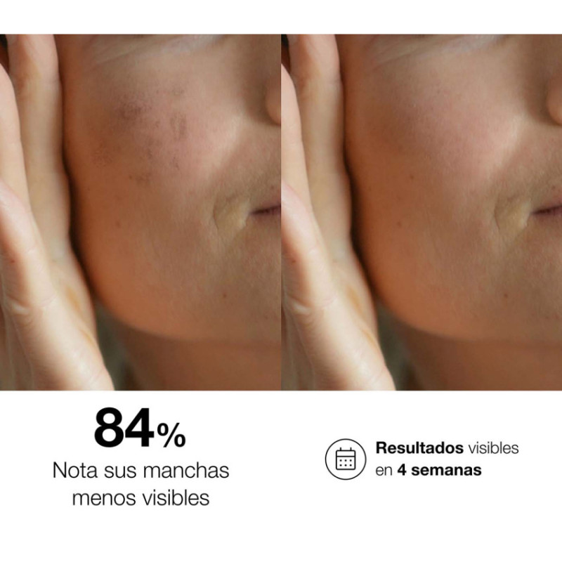 Bella Aurora Tratamiento Intensivo Para Todo Tipo De Piel. Bio10 Forte + Noche