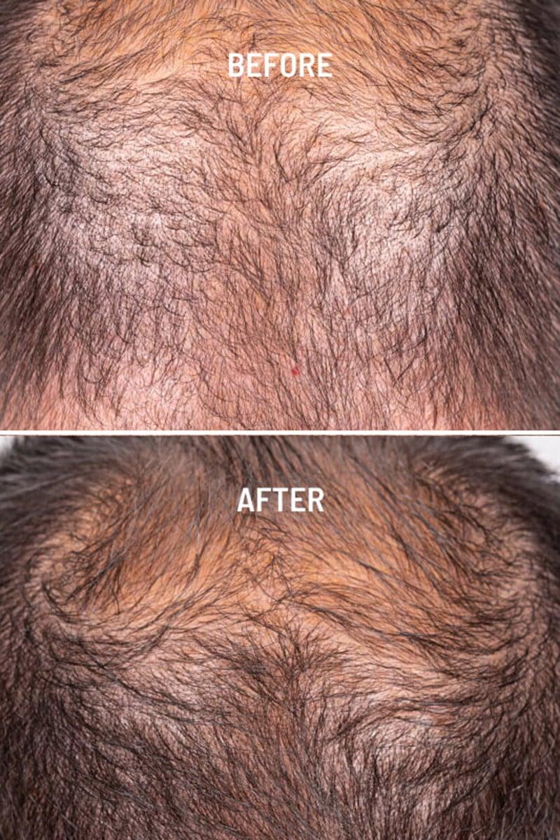 Cortefiel Hair Growth & Density Tratamiento Capilar