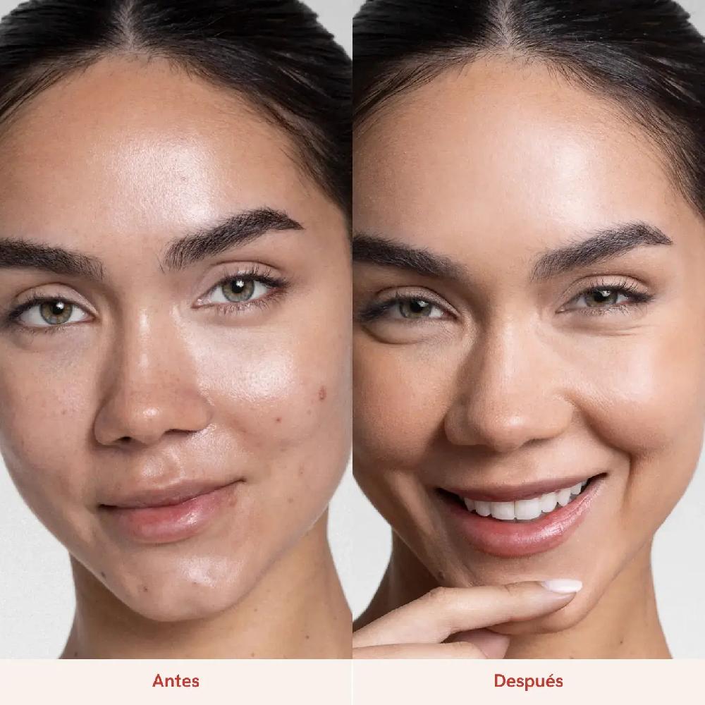 lullage Acnexpert Solution Hidratante Para Pieles Acneicas | Lullage