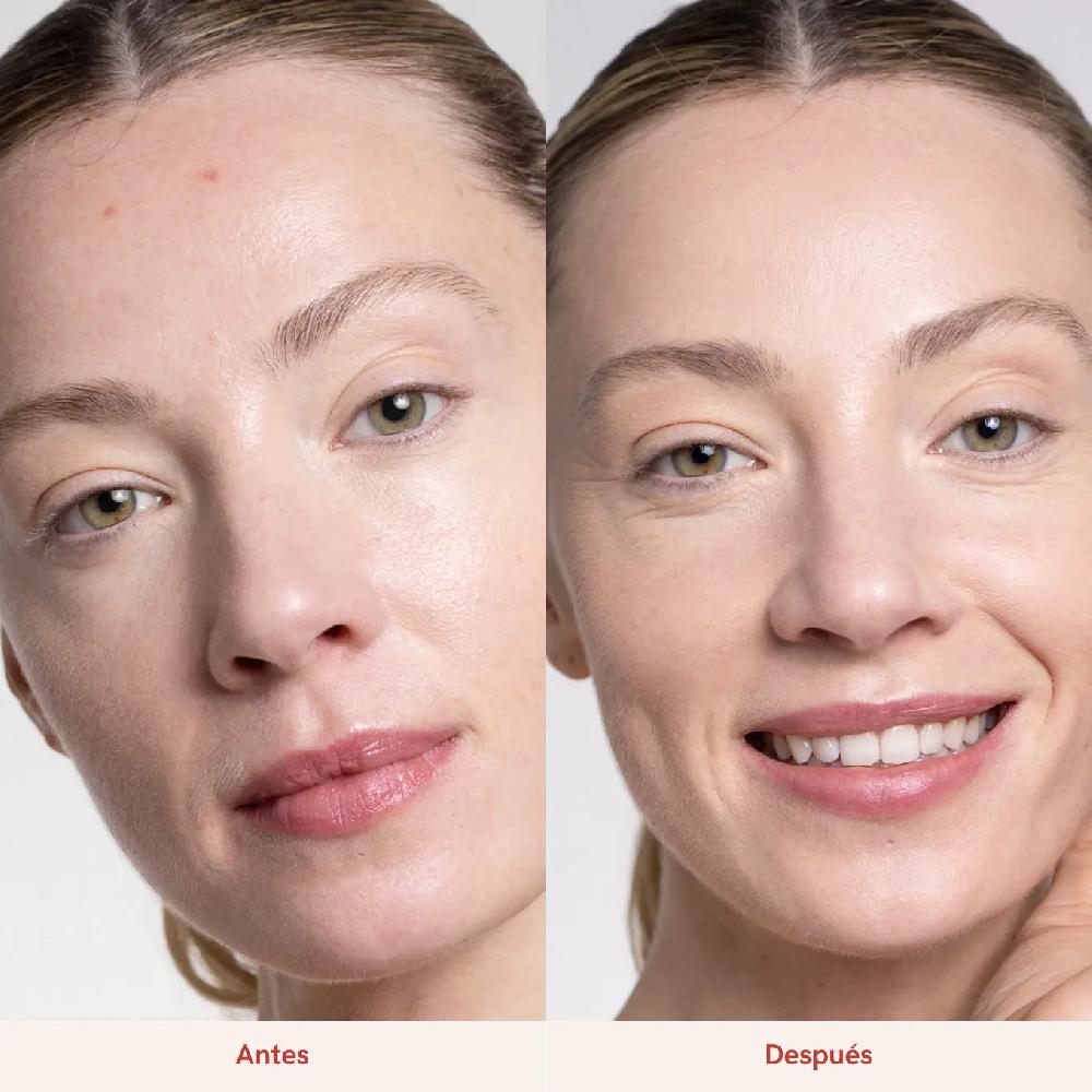 Lullage Bye Bye Pimples Tratamiento Granos Puntuales | Lullage