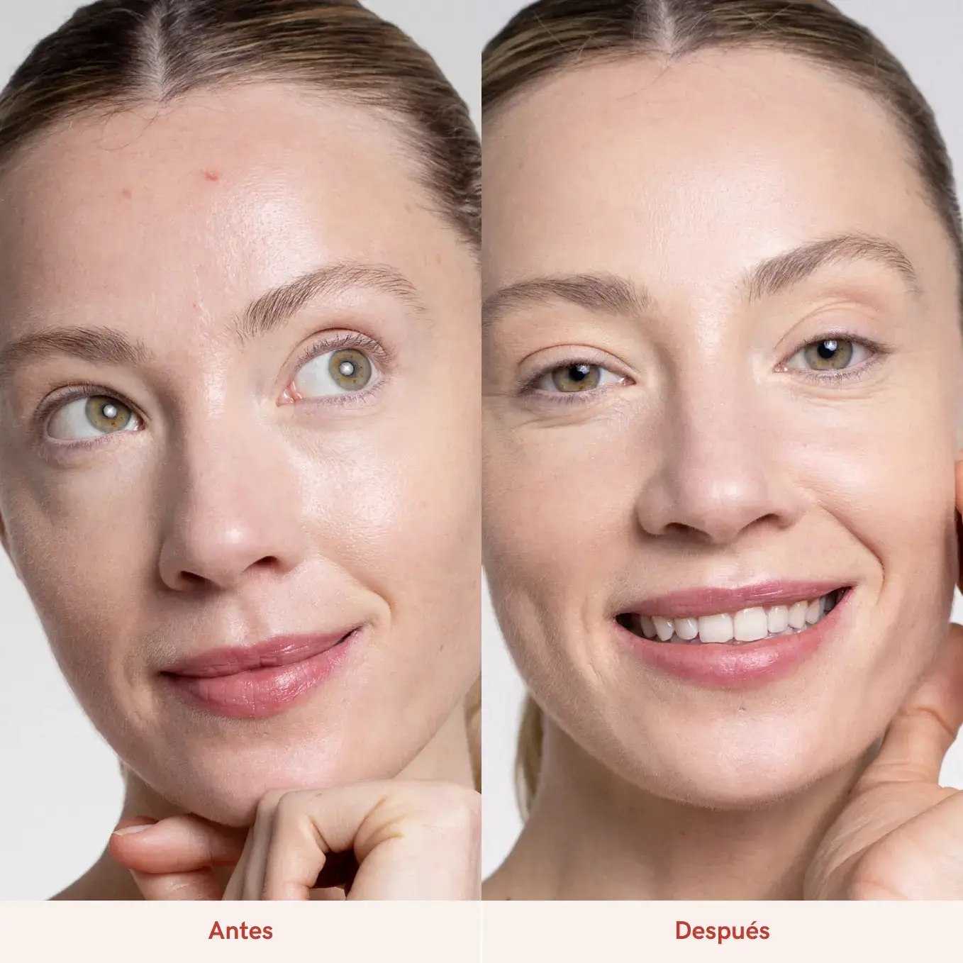 Lullage Skin Perfector Drops Serum Bifásico Antimanchas Y Granos | Lullage