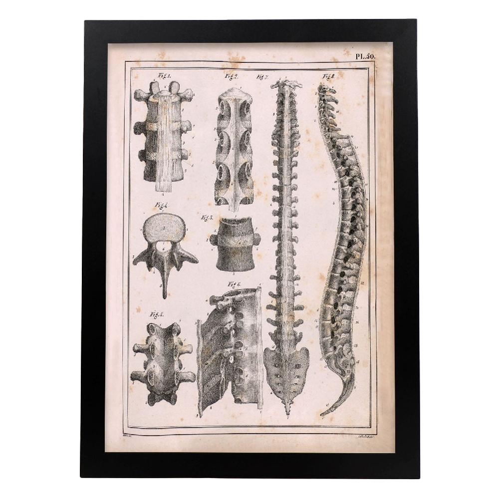 Nacnic Lámina Paillou Espina; Vértebras Sacro Y Cóccix Con Ligamentos