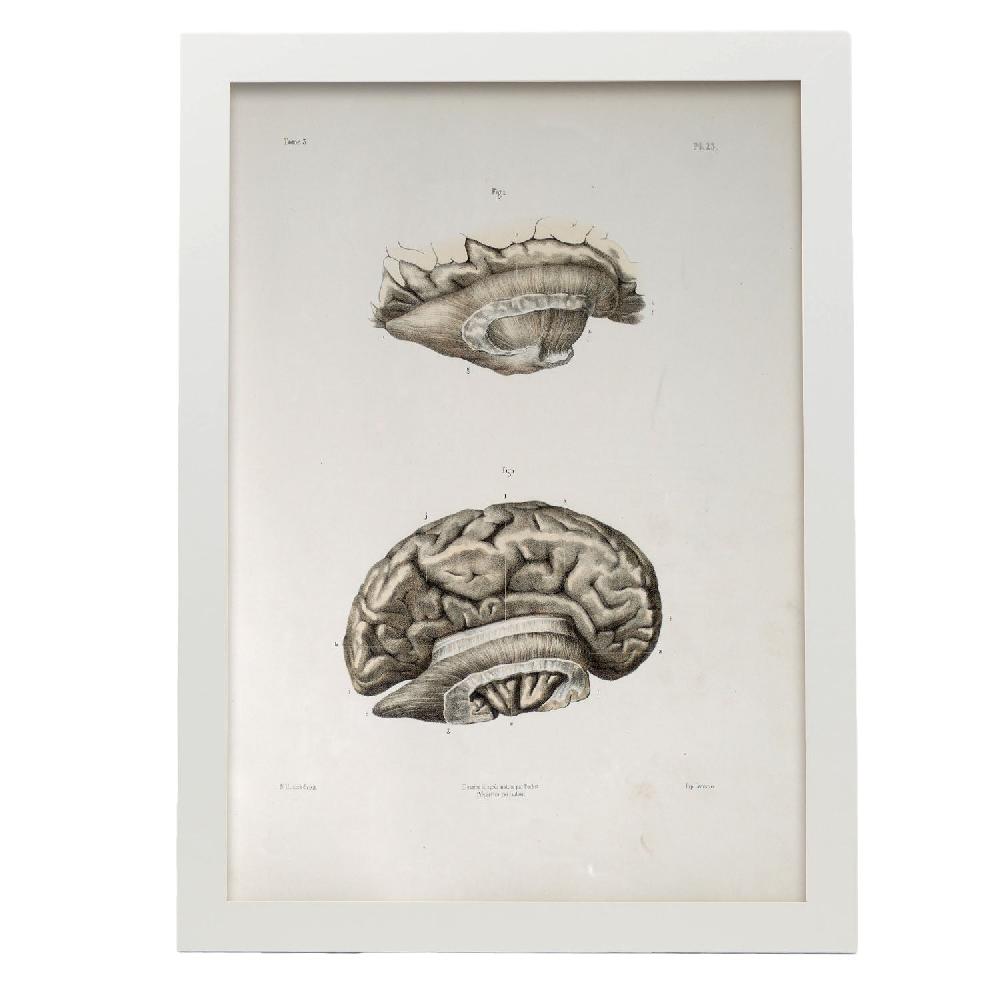 Nacnic Brain Divided In Parasagital Section
