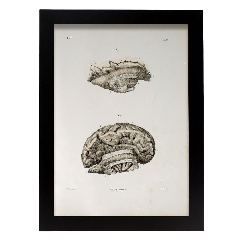 nacnic Brain divided in parasagital section