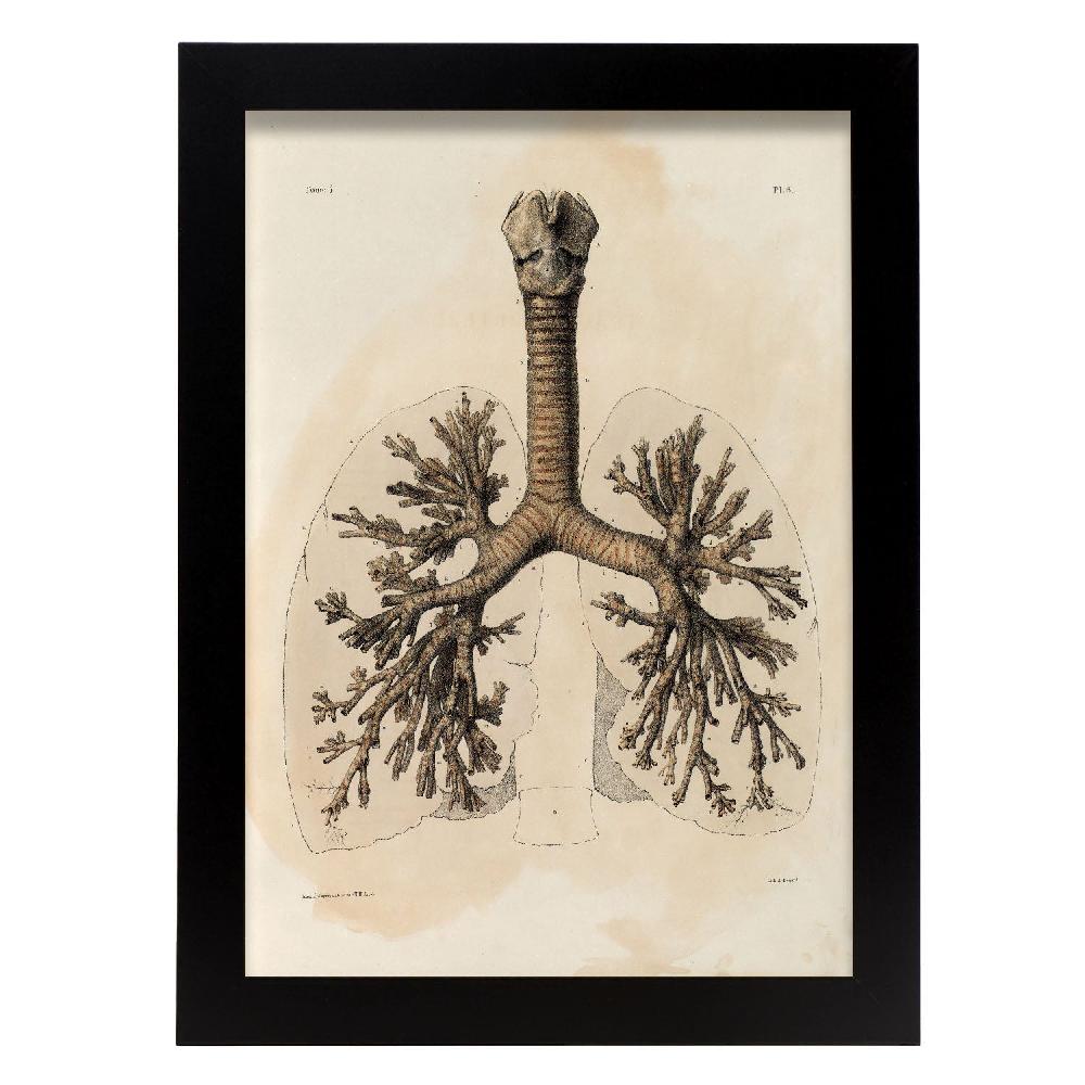 nacnic Bronchi trachea laryngeal cartilages