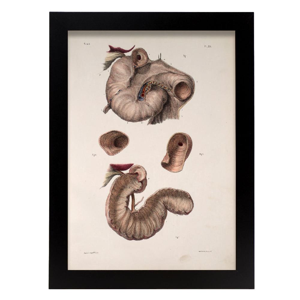 Nacnic Cartel De Duodeno