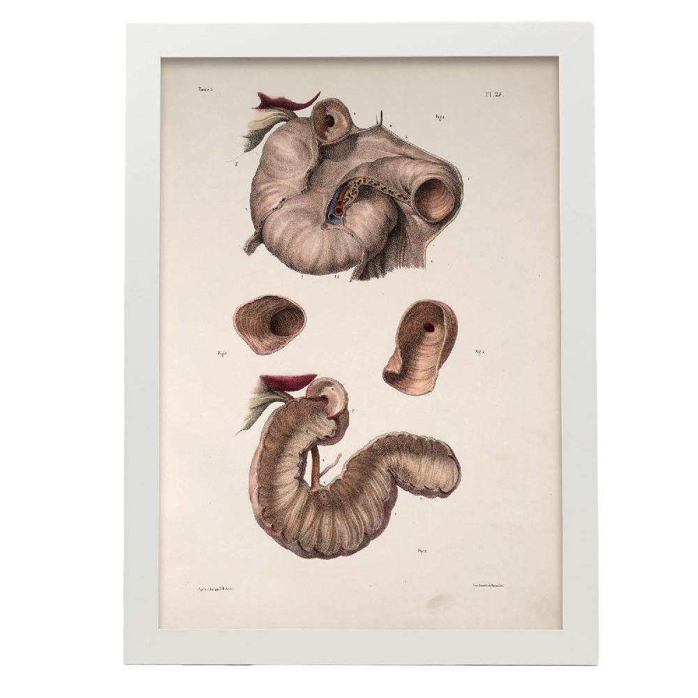 Nacnic Cartel De Duodeno