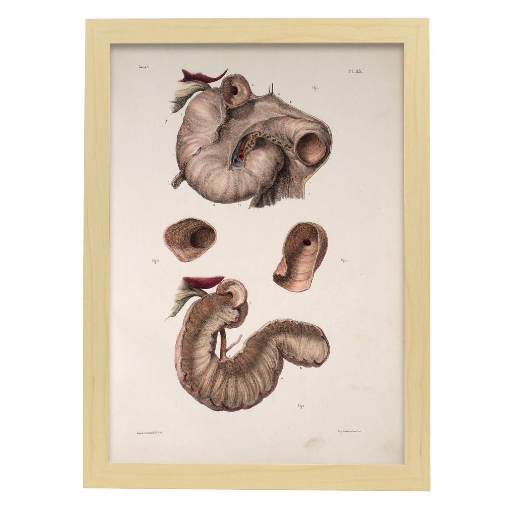 Nacnic Cartel De Duodeno