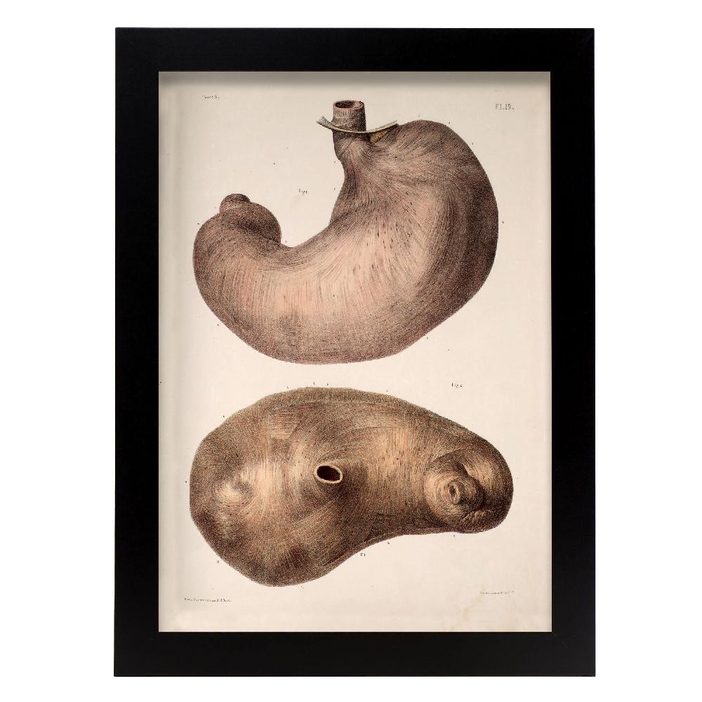 Nacnic Cartel De Estómago