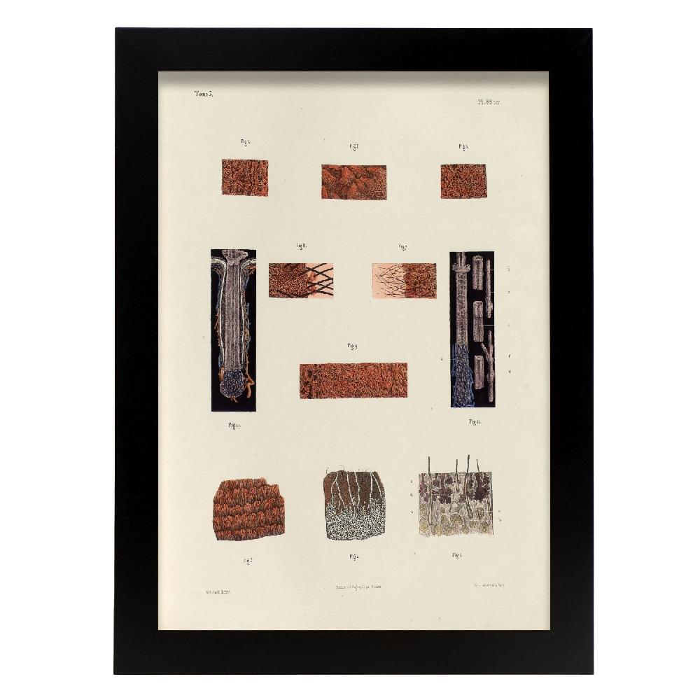 Nacnic Hair Follicles And Sebaceous Glands