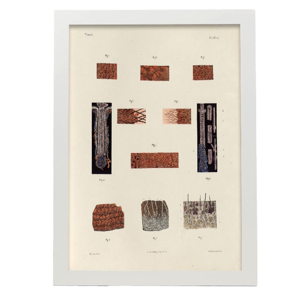 Nacnic Hair Follicles And Sebaceous Glands