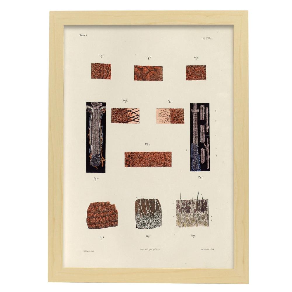 Nacnic Hair Follicles And Sebaceous Glands