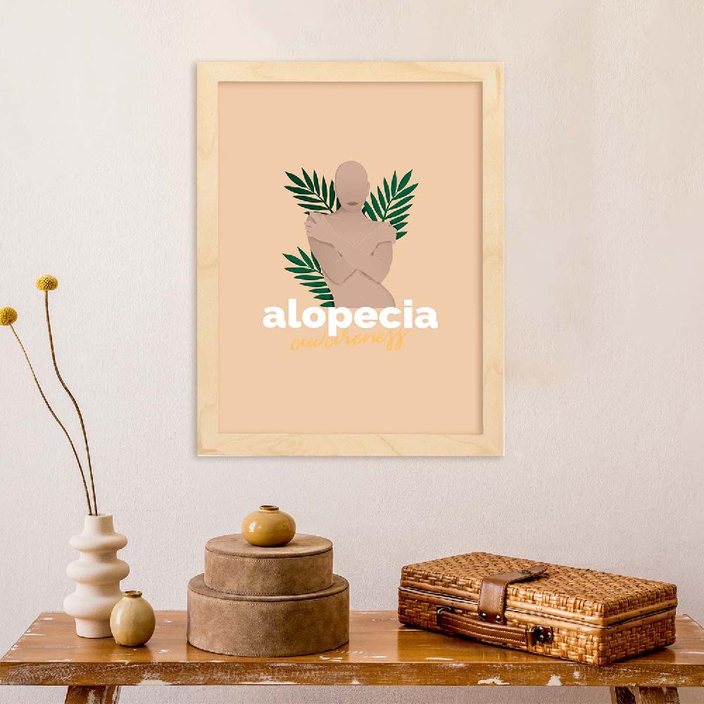 Nacnic Lámina De Amor Propio Y Aceptación Alopecia