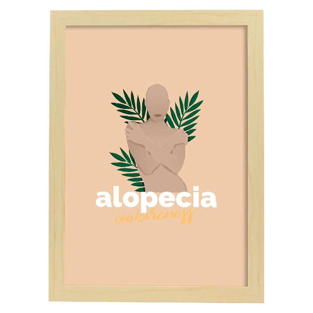 Nacnic Lámina De Amor Propio Y Aceptación Alopecia
