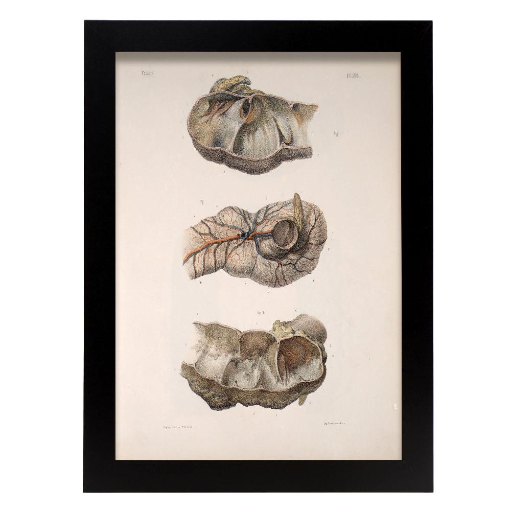 Nacnic Large Intestine; Cecum And Appendix