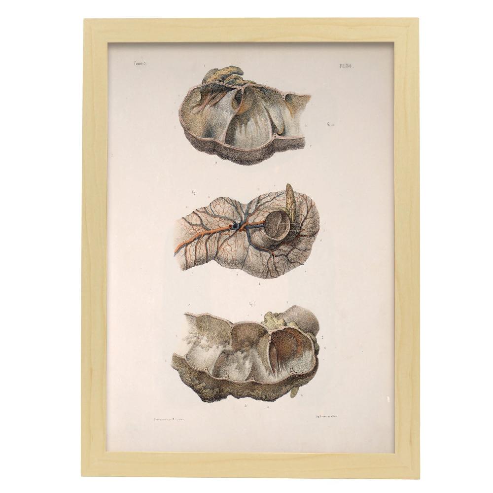 Nacnic Large Intestine; Cecum And Appendix