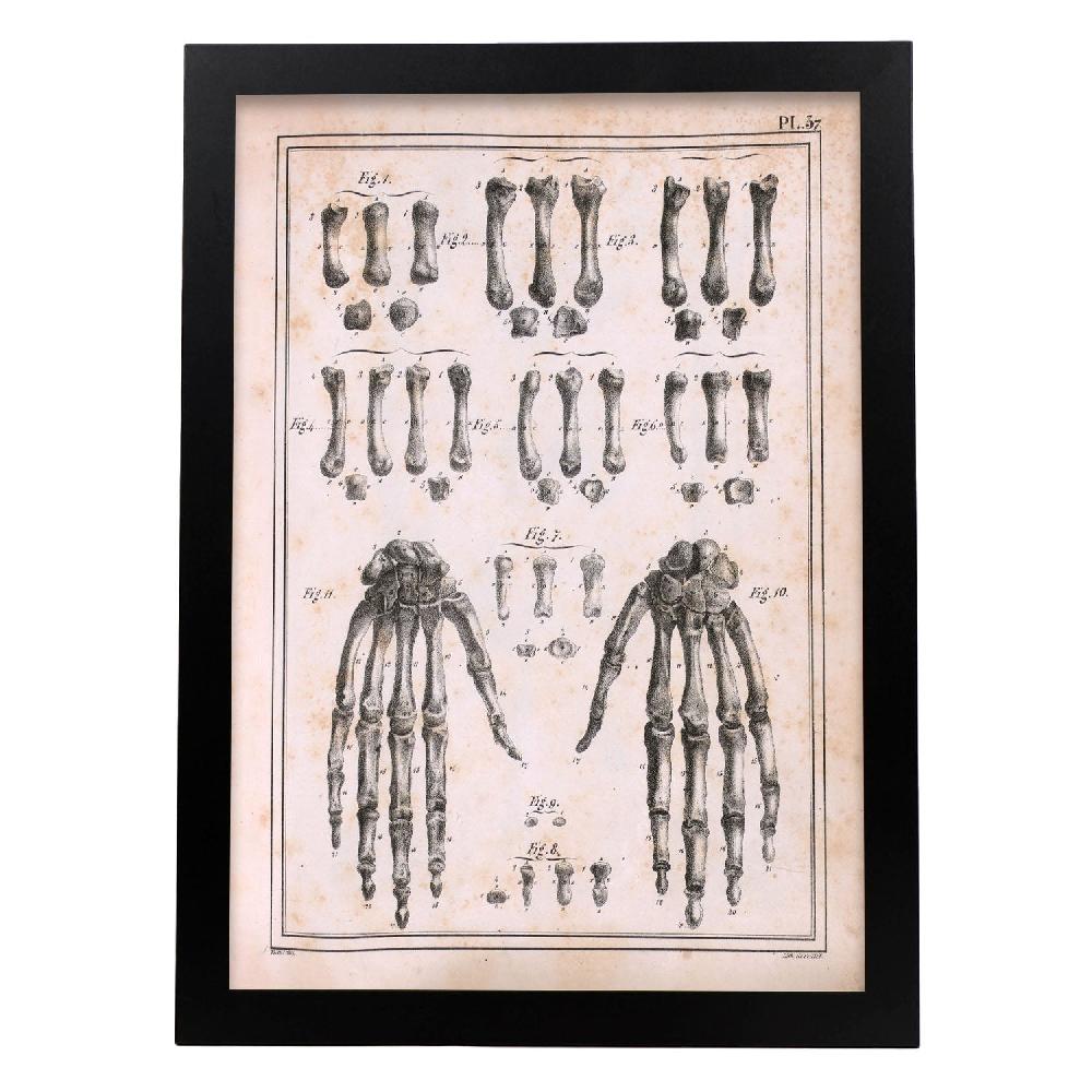 Nacnic Paillou Carpal Bones And Metacarpus