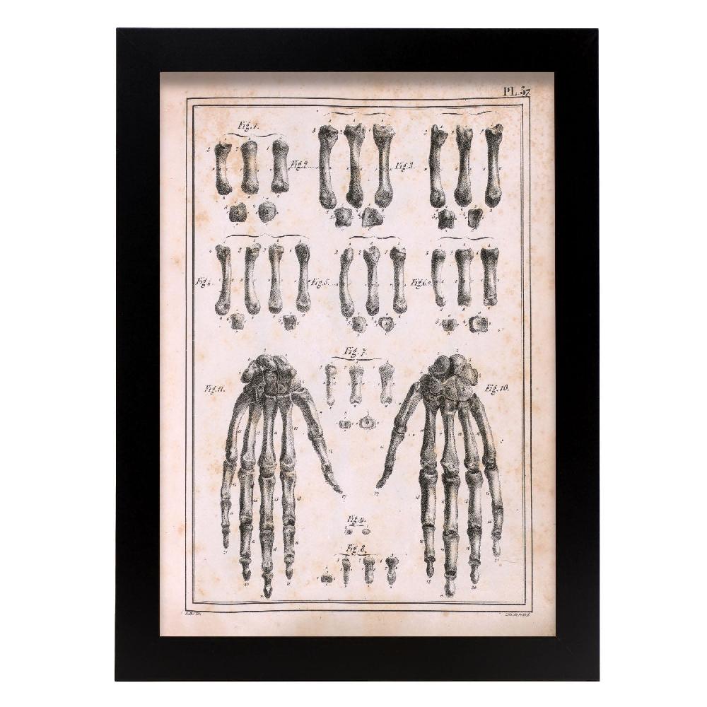 nacnic Paillou Carpal bones and metacarpus