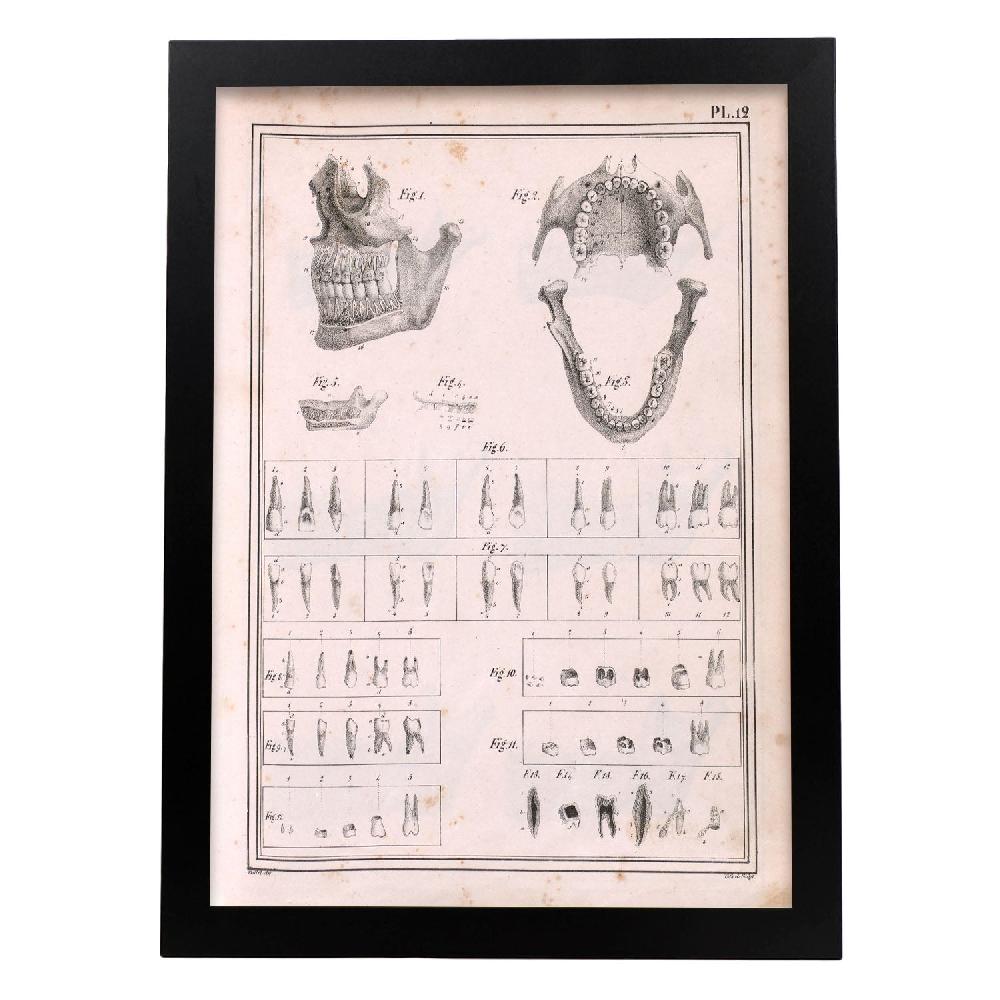 Nacnic Paillou Teeth Maxilla And Mandible