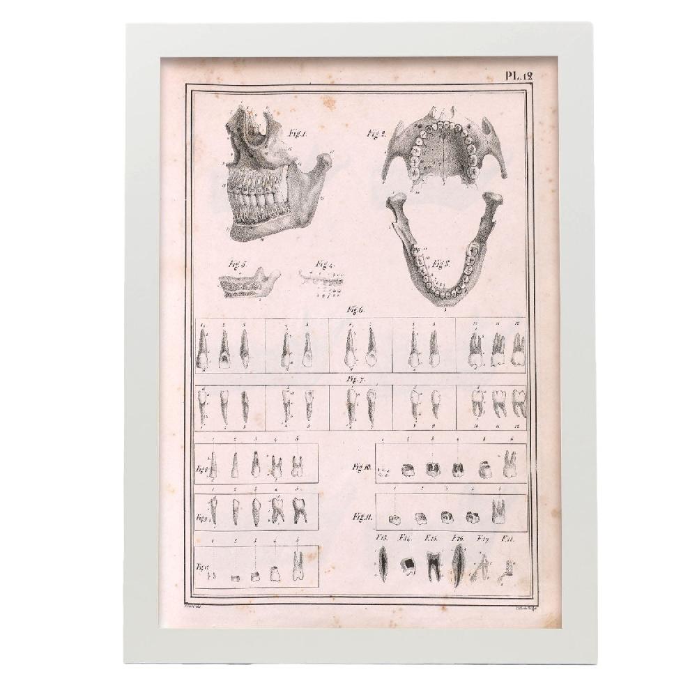 Nacnic Paillou Teeth Maxilla And Mandible