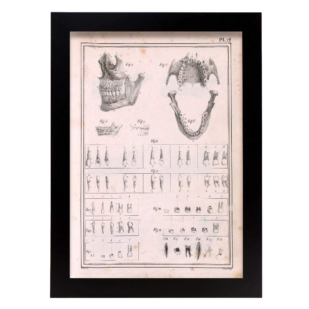 nacnic Paillou Teeth maxilla and mandible