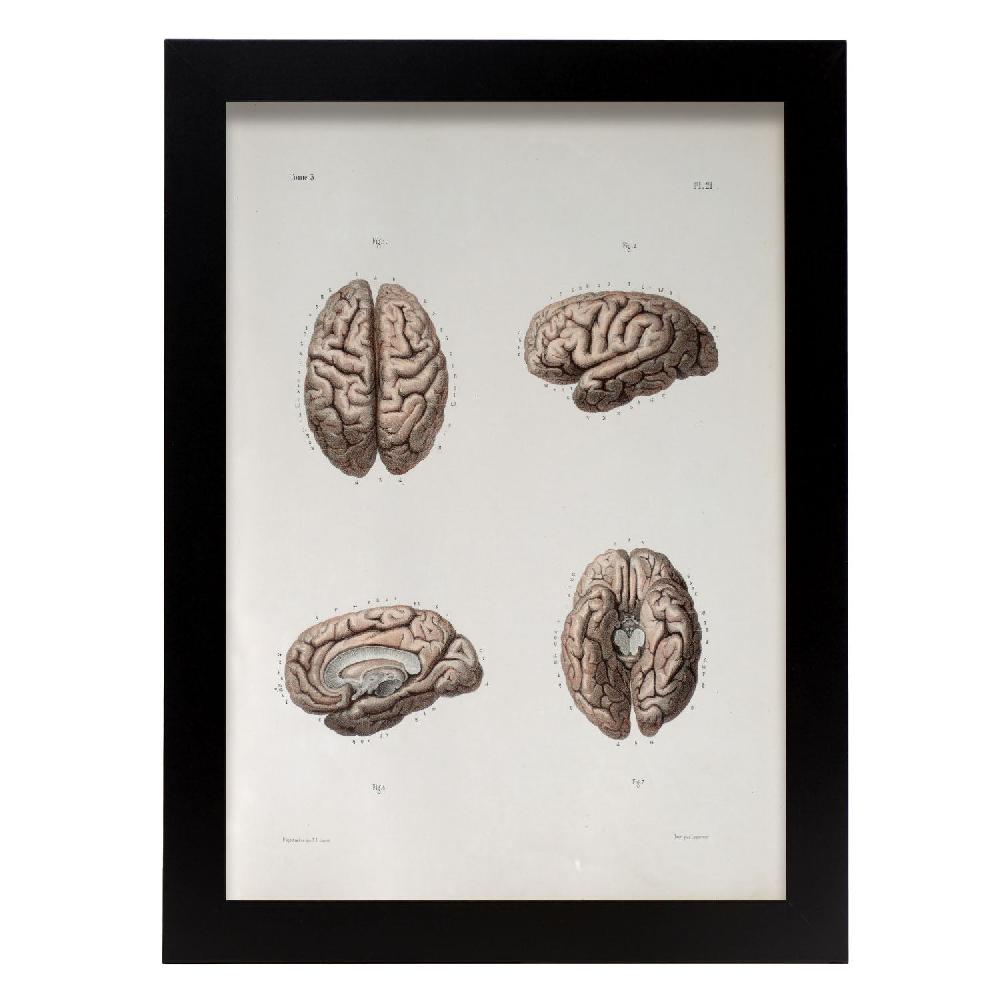 Nacnic Póster De Brain: Explorando La Mente