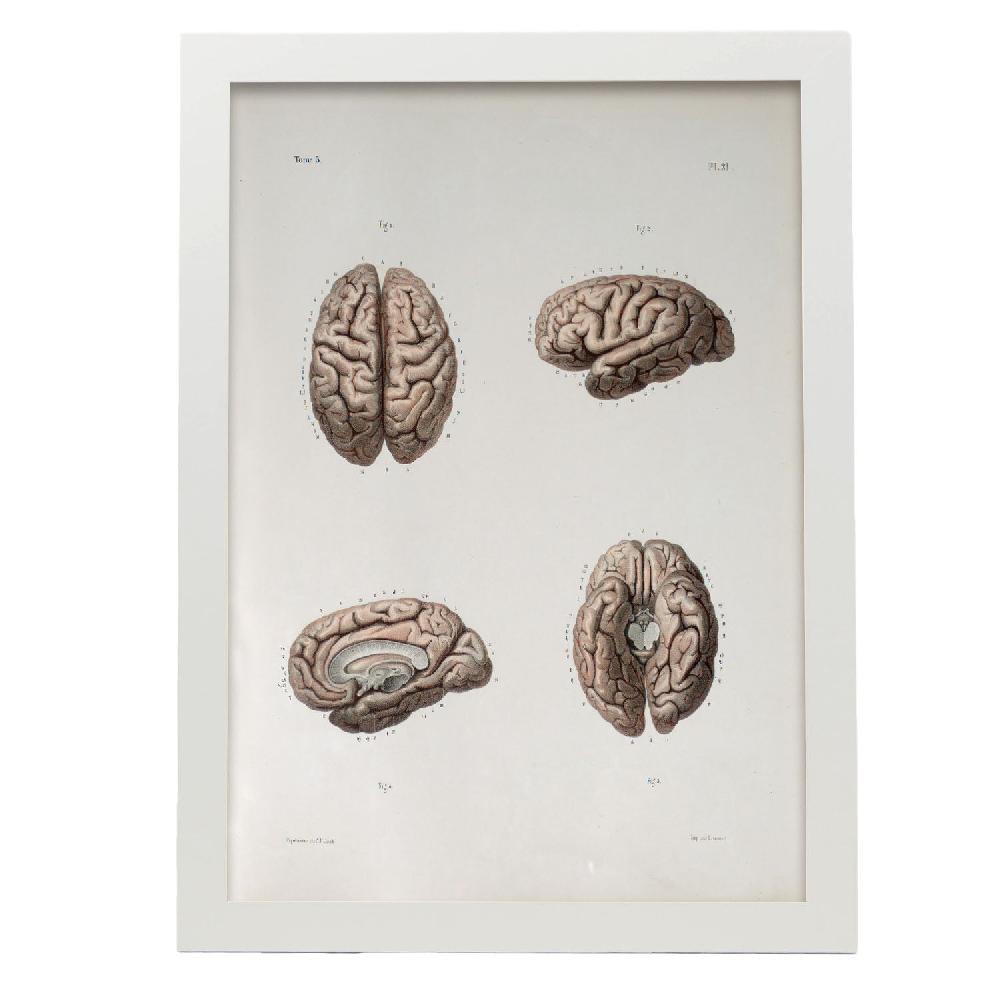 Nacnic Póster De Brain: Explorando La Mente