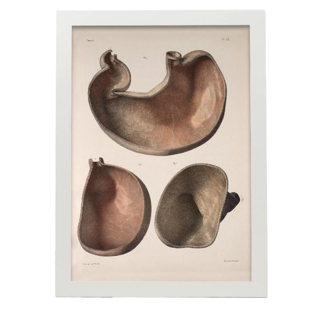 Nacnic Póster De Estómago Transversal