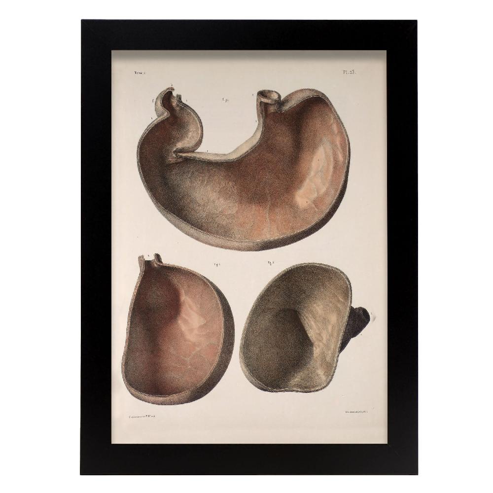 nacnic Póster de Estómago Transversal