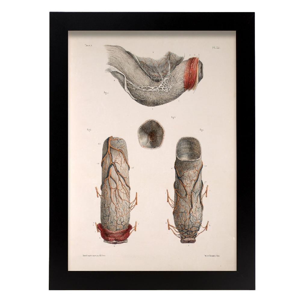 Nacnic Póster De Intestino Grueso Y Recto