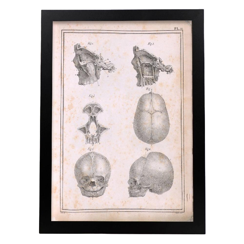 Nacnic Póster De Paillou Fetal Skull