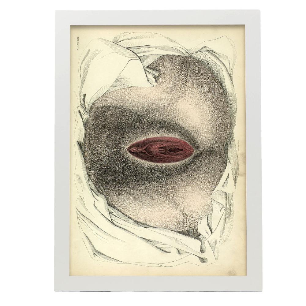 Nacnic Urogenital System Female; Perineum