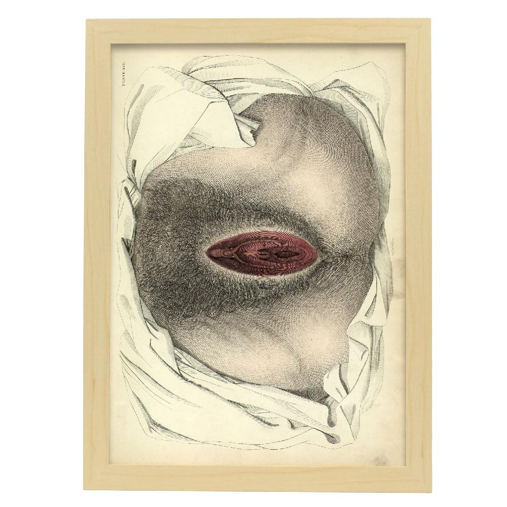 Nacnic Urogenital System Female; Perineum