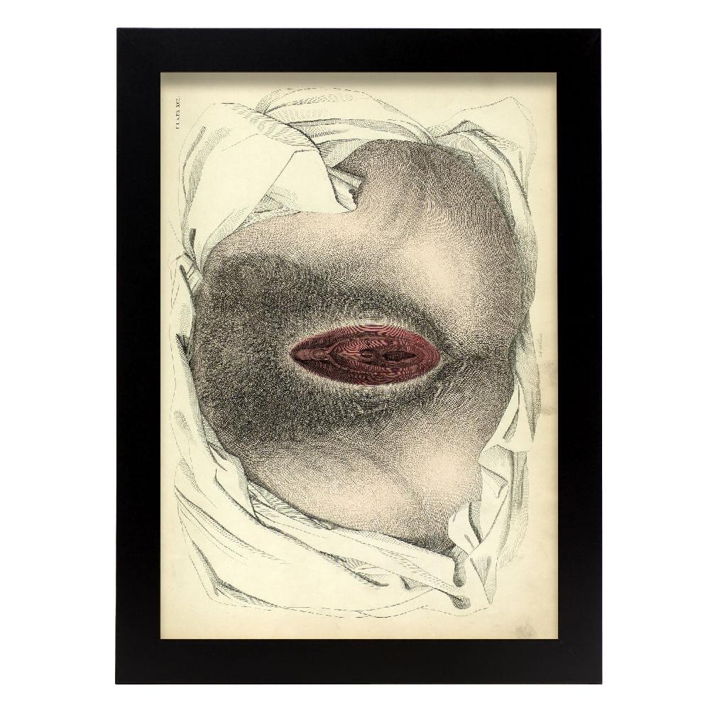nacnic Urogenital system female; perineum