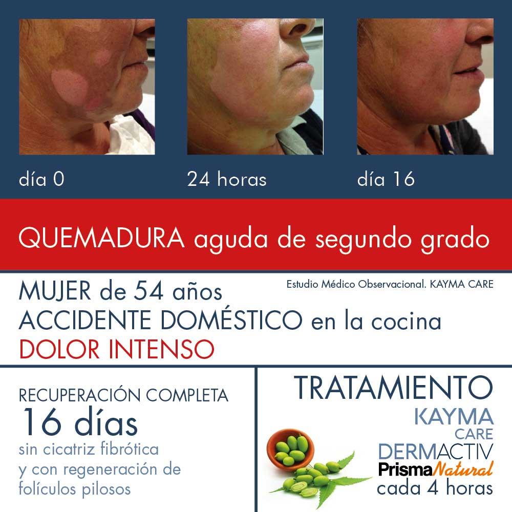 Prisma Natural KAYMA CARE DERMACTIV