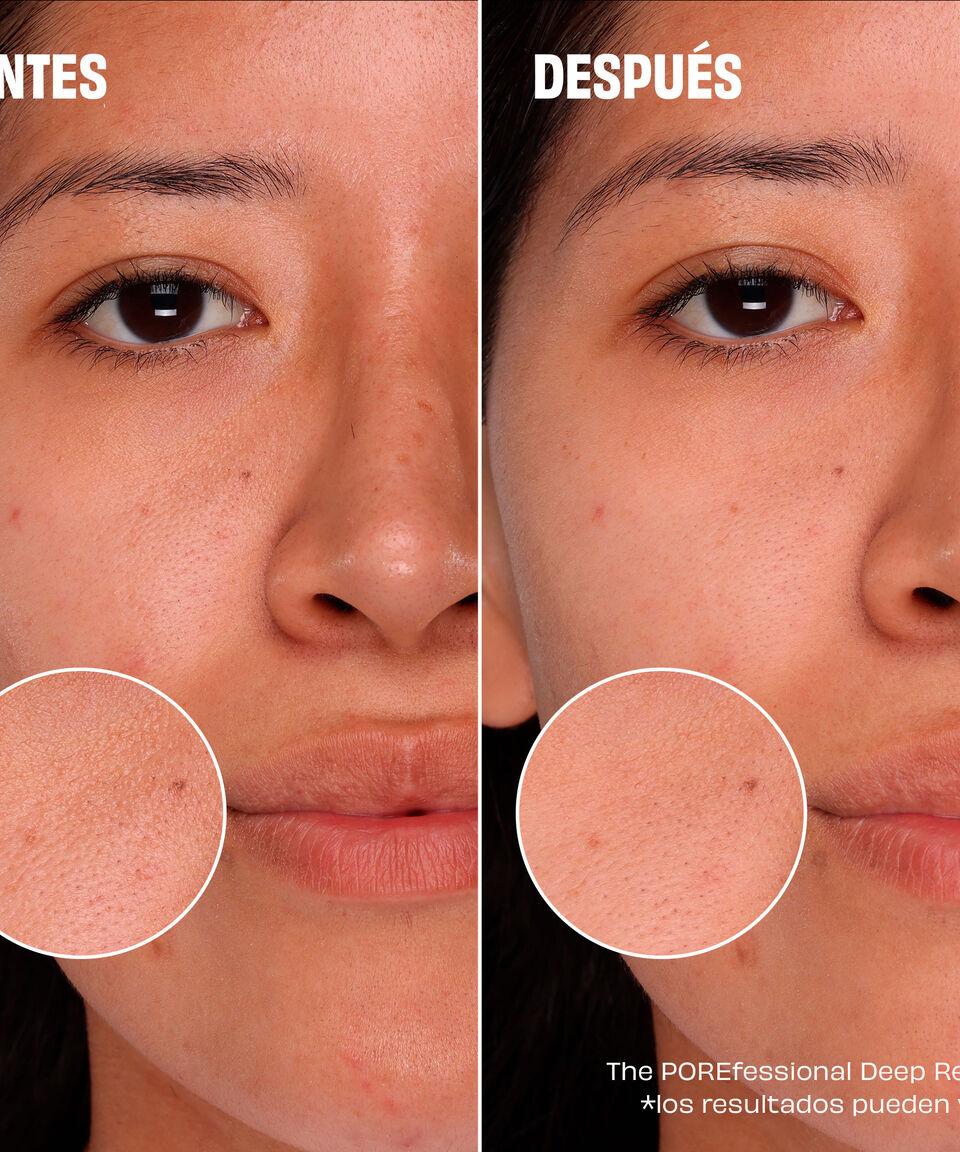 Benefit Set All You Knead Is Pore Care