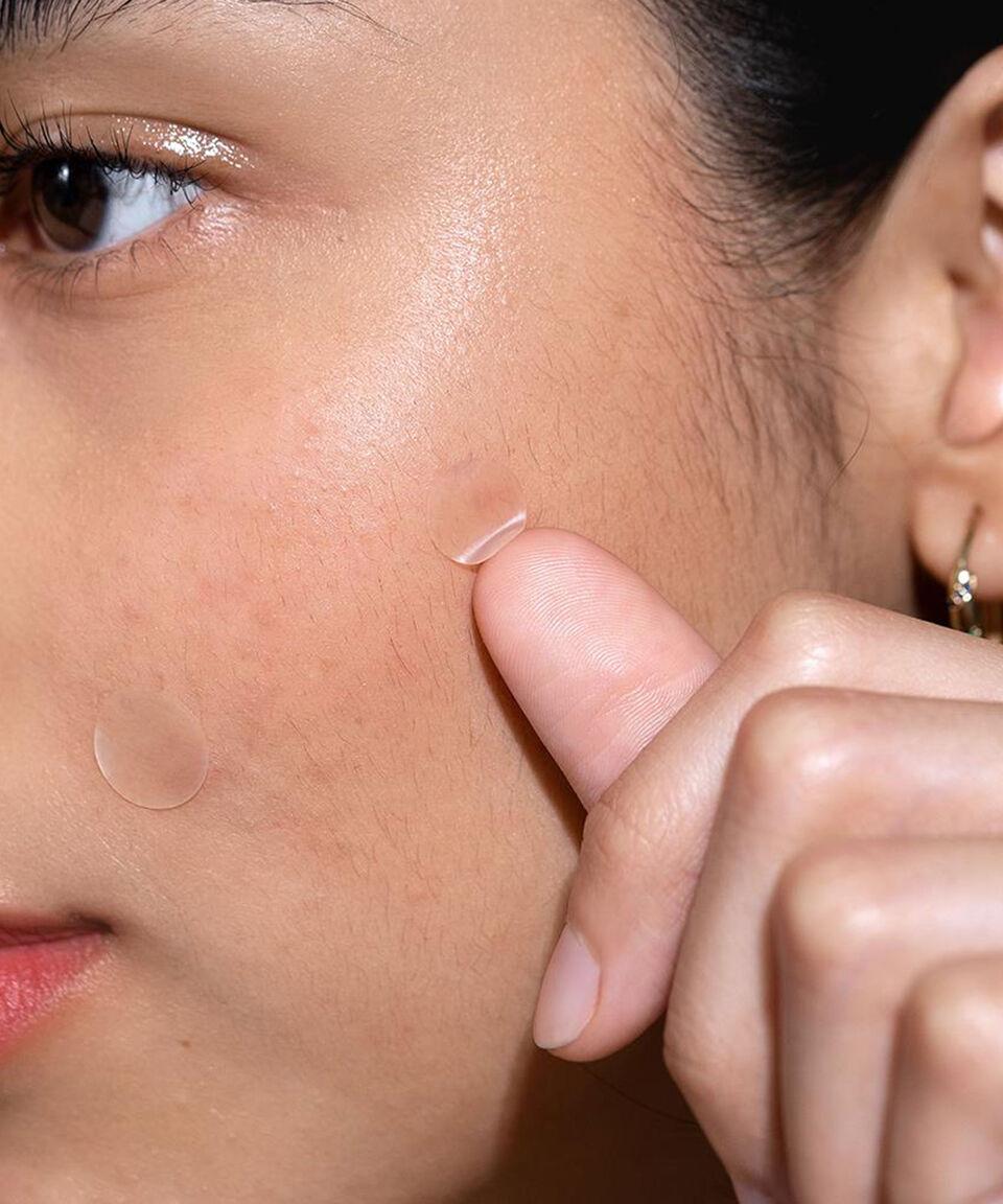 Momiji Parches Faciales Pimple Hugger 24 Piezas 5 Gr