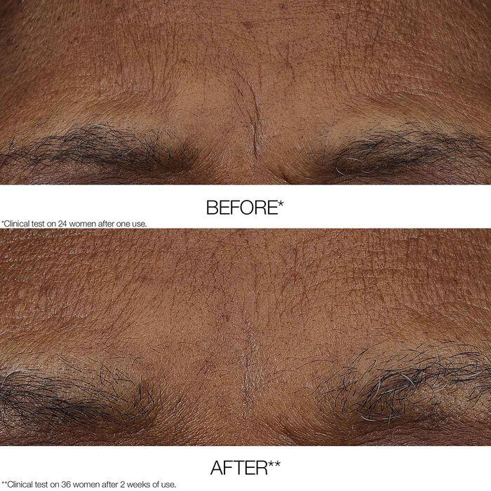 Clinique Clinique Smart Clinical Repair - Bálsamo Retinoide Mañana Y Noche