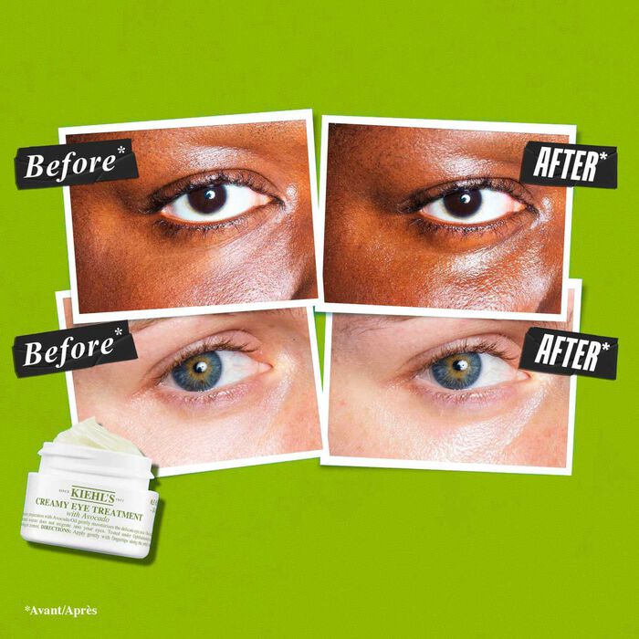 Kiehl's Since 1851 Creamy Eye Treatment With Avocado - Crema Contorno De Ojos Hidratante
