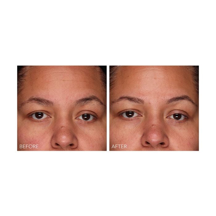 Dr. Dennis Gross DermInfusions - Gel Regeneración Rápida