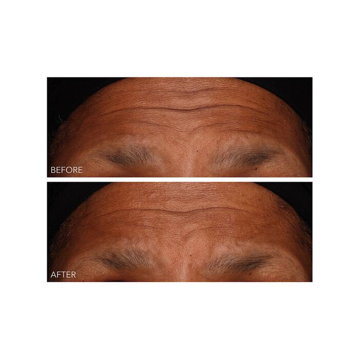 Dr. Dennis Gross DermInfusions - Gel Regeneración Rápida