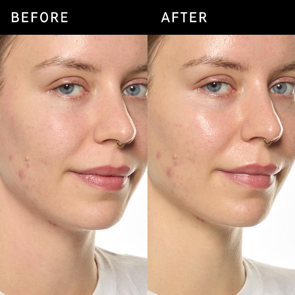 The Inkey List Ectoin Hydro-Barrier Serum - Sérum Hidratante Y Protector