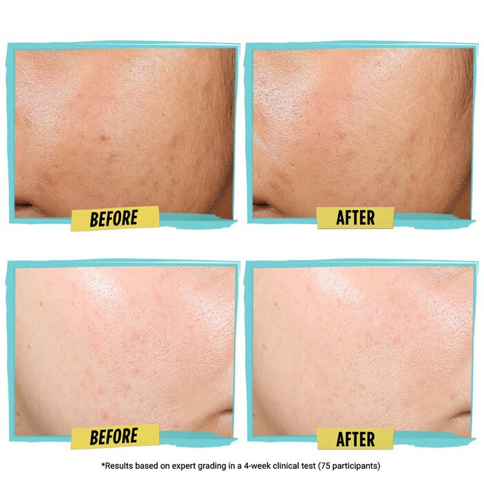 Kiehl's Since 1851 Expertly Clear Blemish - Treating & Preventing Lotion