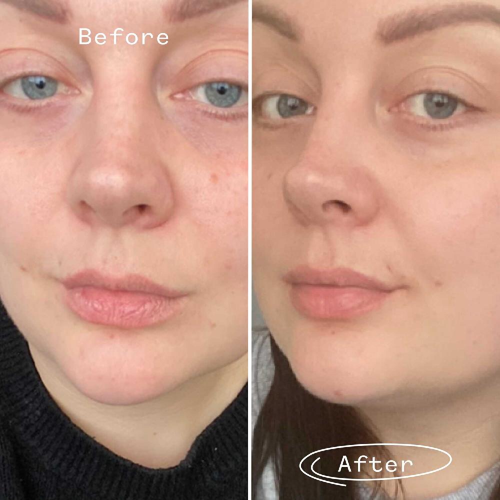 Pai Rosehip Bioregenerate - Aceite Universal De Rosa Mosqueta